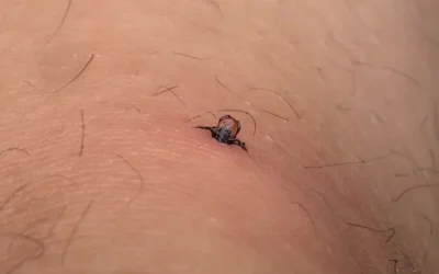 Solução e Dicas para afastar os Carrapatos